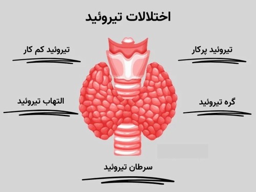 پزشکی فرد محور در اختلالات تیروئید: رویکردی نوین از ژنوم تا میکروبیوم